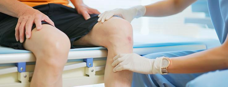 Image of Knee Injury